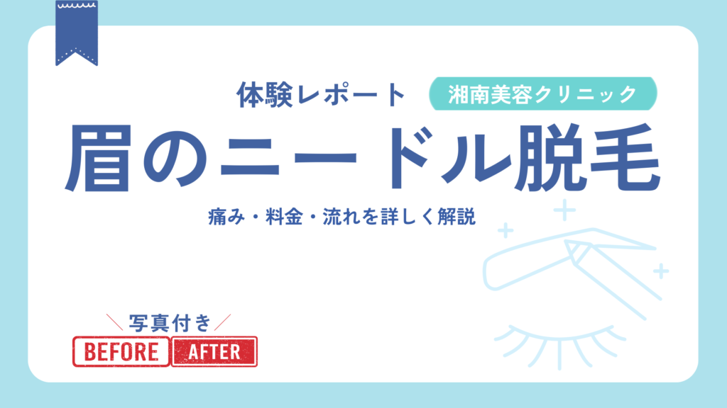 眉のニードル脱毛体験レポート湘南美容クリニックにて：痛み・費用・流れ・ビフォーアフター写真付き