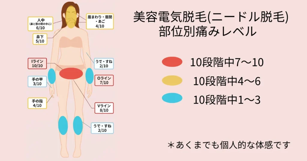 美容電気脱毛(ニードル脱毛)部位別痛みレベル

Iライン：10/10
Vライン：8/10
Oライン：7/10
人中：6/10
鼻下：5/10
眉周り・眉間・あご：4/10
手の指：4/10
手の甲：3/10
腕・すね：2/10
＊私自身が実際に体感した主観的な感想です。
