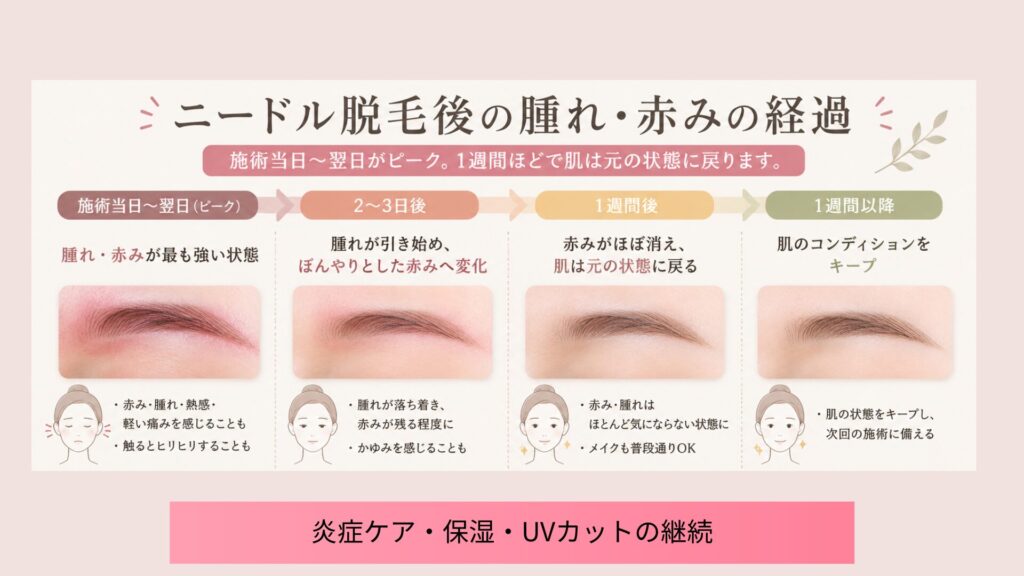 ニードル脱毛後の腫れ・赤みの経過
・当日から翌日：腫れ・赤みが最も強い状態
・２〜３日後：腫れが引き始め、ぼんやりとした赤みへ変化
・１週間後：赤みがほぼ消え、肌は元の状態に戻る
・１週間以降：肌のコンディションの状態により、ケアを継続する