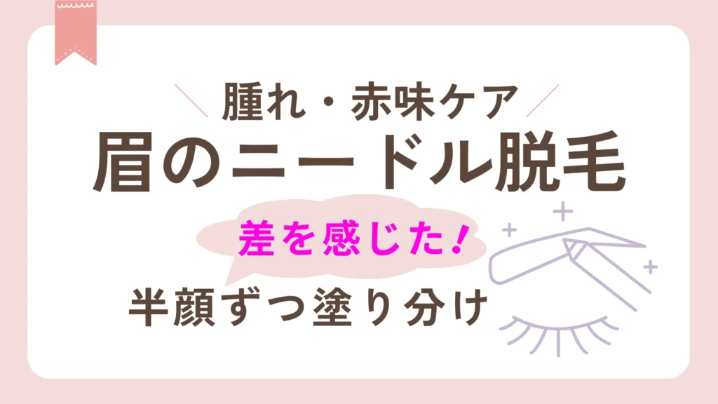 眉ニードル脱毛後の腫れ・赤味ケア　半顔ずつクリーム塗り分け、炎症ケア成分で差を感じた