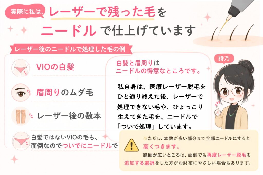実際に私は、レーザー脱毛で取りきれない毛をニードル脱毛で処理しています。 例えば、VIOの白髪・眉周りのムダ毛・レーザー後の数本の毛・白髪ではないVIOの毛も、面倒なのでニードル脱毛の施術の際に、「ついでにニードル脱毛で処理」しています。*ただし、本数が多い部分までニードル脱毛で次いで脱毛すると、高くつきます。範囲が広いところは、面倒でも再度レーザー脱毛を追加する選択をした方が、お財布に優しい場合もあります。