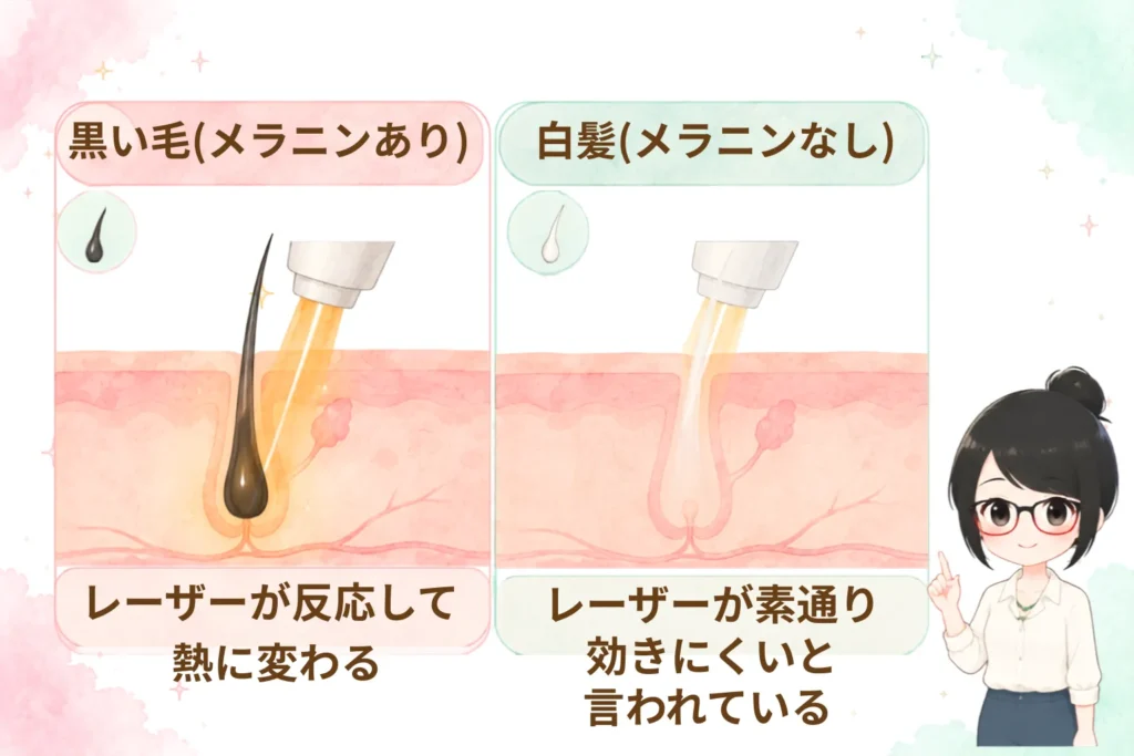 黒毛と白髪へのレーザーの反応
・黒い毛にあるメラニンにレーザーが反応して熱に変わる。脱毛効果あり。
・白髪にはメラニンがないため、レーザーが素通りする。脱毛には効きにくいと言われている。