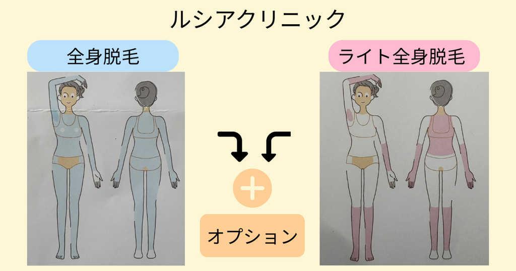 ルシアクリニックの「全身脱毛コース」と「ライト全身脱毛」の範囲比較図。水色が全身脱毛コース、ピンクがライト全身脱毛、オレンジがオプション部位(顔・襟足/首・VIO)の範囲