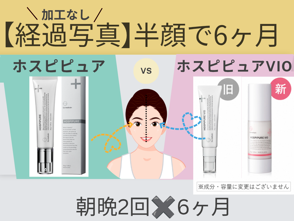 【経過写真】ホスピピュアとホスピピュアVIO