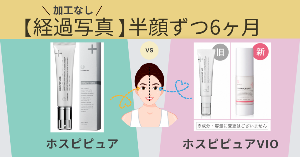 加工なし【６ヶ月の経過写真】ホスピピュアとホスピピュアVIOを半顔ずつ使用