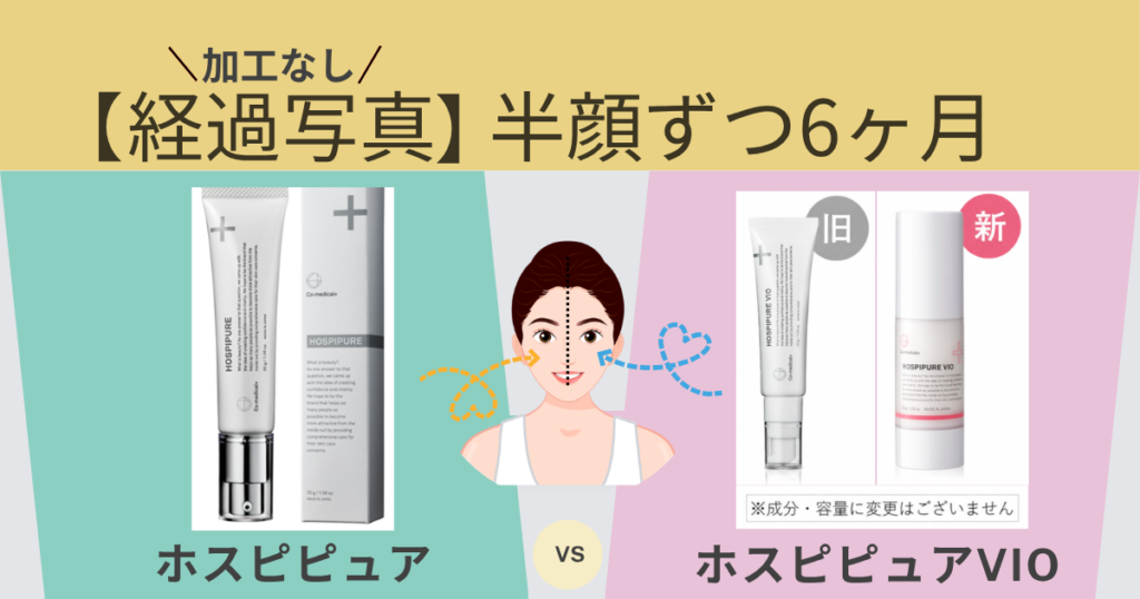 加工なし【６ヶ月の経過写真】ホスピピュアとホスピピュアVIOを半顔ずつ使用